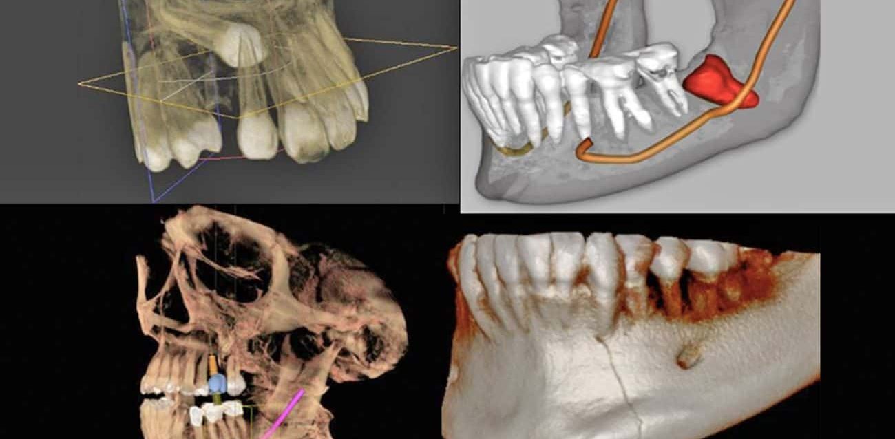 cone-beam-dental-blog-principal