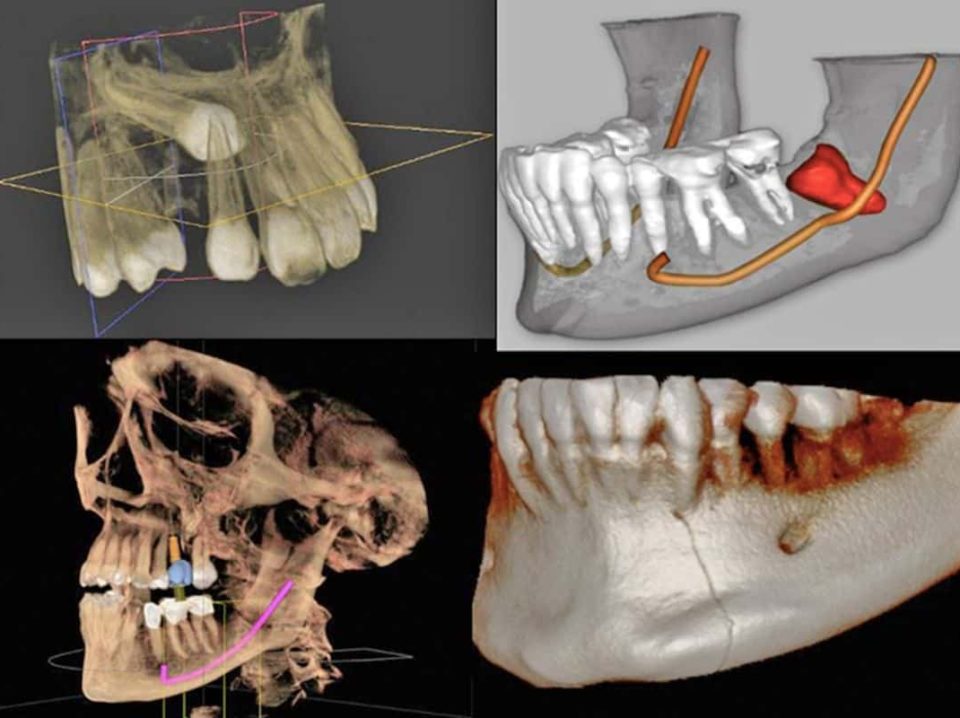 cone-beam-dental-blog-principal