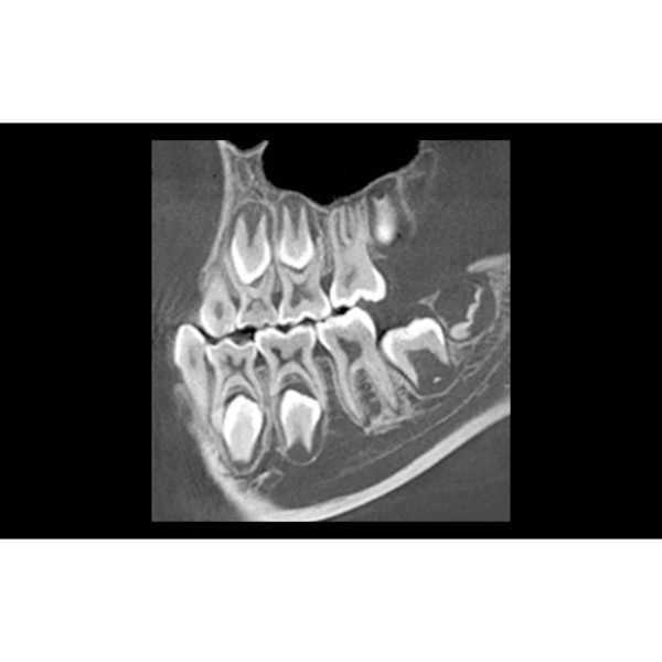 HiRes3D - Imagen 2