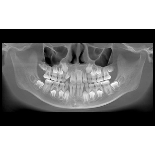 HiRes3D - Imagen 3